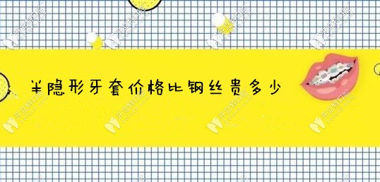 告訴你半隱形牙套價(jià)格比鋼絲貴多少,避免矯正牙齒時(shí)踩雷哦