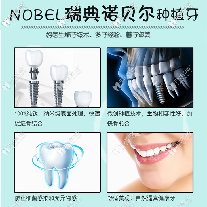 瑞典諾貝爾種植體優(yōu)勢