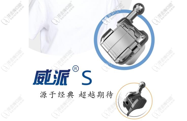 被cue到的國產(chǎn)威派自鎖托槽咋樣?速看3b威派托槽價格及原理