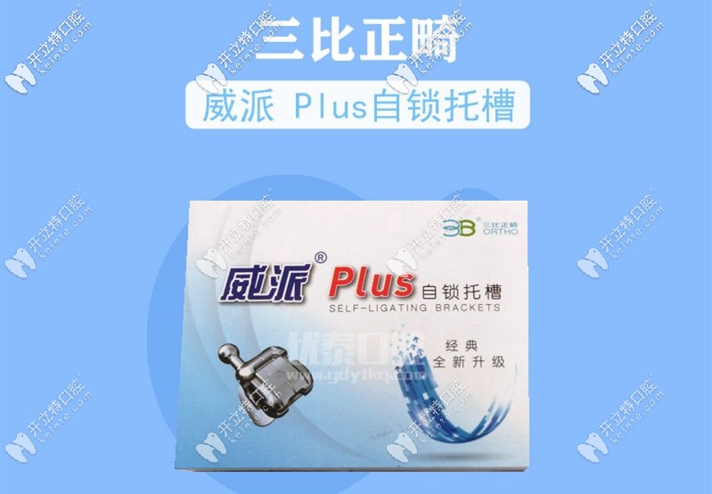 威派plus自鎖托槽