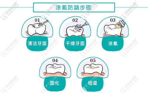 涂氟的過程
