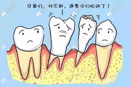 牙周病導(dǎo)致牙齒松動