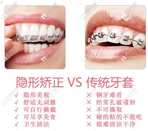 隱形牙套和鋼絲牙套對(duì)比