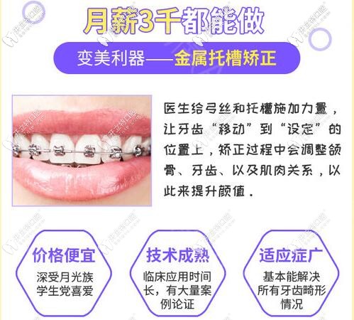 傳統(tǒng)金屬牙齒矯正優(yōu)點