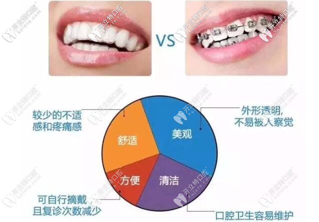 鋼絲牙套和隱形牙套的區(qū)別