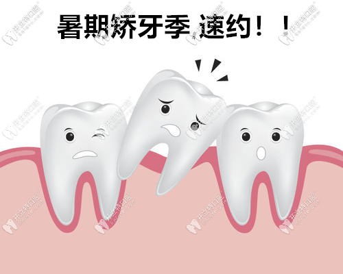 暑期矯正大放價,蘇州做時代天使comfos牙套價格低到18000元起