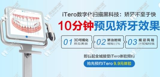 矯正黑科技itero口掃價(jià)格 惠州致美口腔