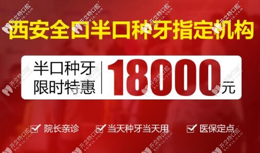 西安中諾口腔半口種植牙價格