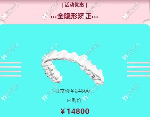 悄悄告訴你來(lái)中山好民生牙科有正雅Smartee隱形牙套內(nèi)購(gòu)價(jià)哦