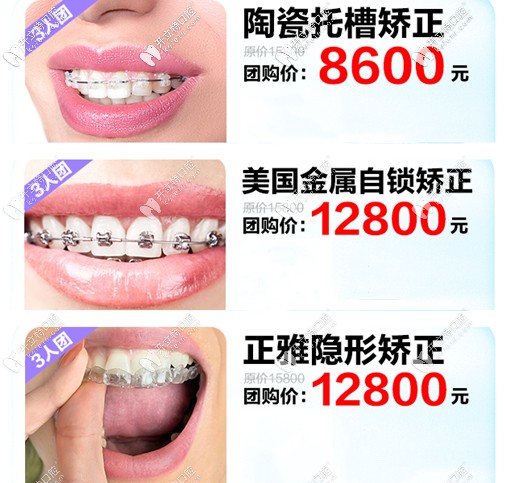 廣州家庭醫(yī)生口腔的正畸拼團(tuán)價介紹