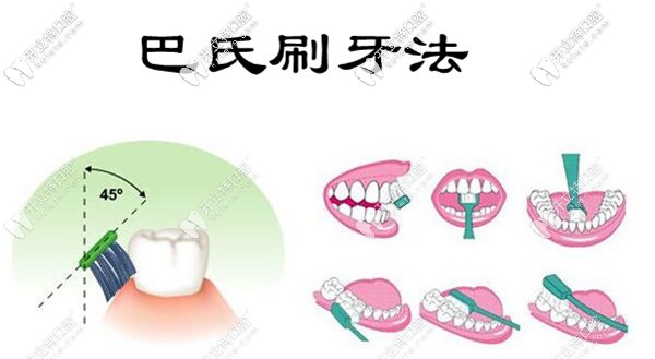 巴氏刷牙法