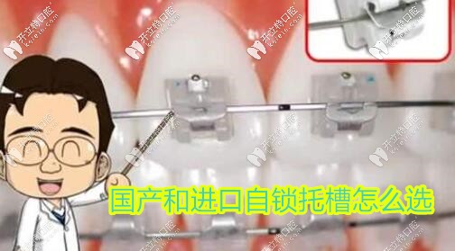 國(guó)產(chǎn)和進(jìn)口自鎖托槽區(qū)別