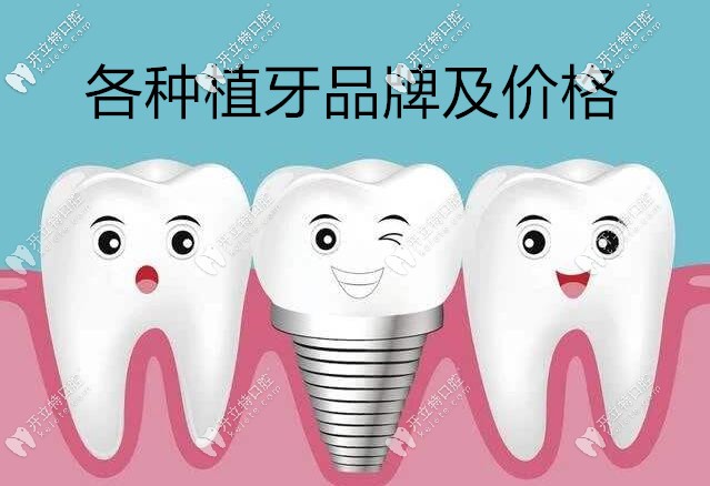 各種植牙品牌及價格