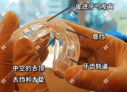兒童功能矯治器 兒童功能矯治器