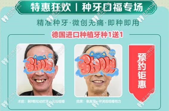 八月廣州廣大口腔的美國(guó)進(jìn)口種植牙5750元就能帶走哦