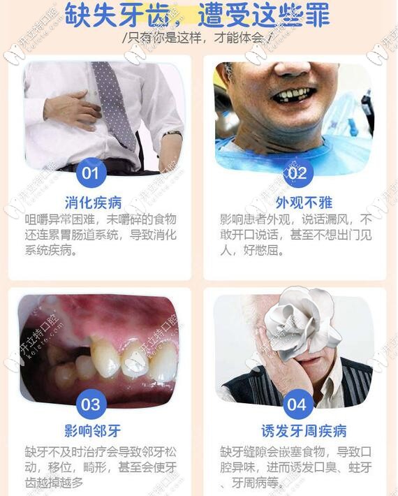 福清維樂(lè)口腔科普牙齒缺失的危害