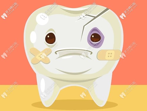王龍波淺談根管治療后的牙齒為何要戴牙冠