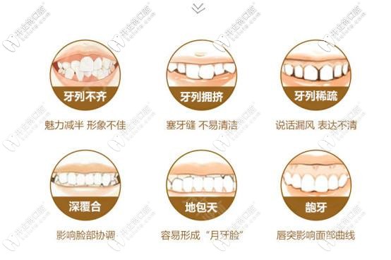 鋼牙套矯正器適應(yīng)癥