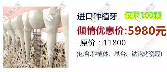 請看在濟南做韓國奧齒泰種植牙多少錢一顆