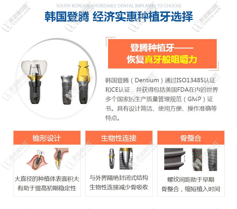 韓國登騰種植牙的質(zhì)量怎么樣