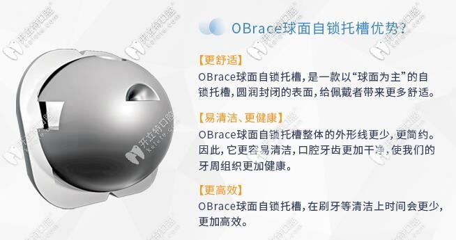 OBrace球面自鎖托槽的優(yōu)勢(shì)