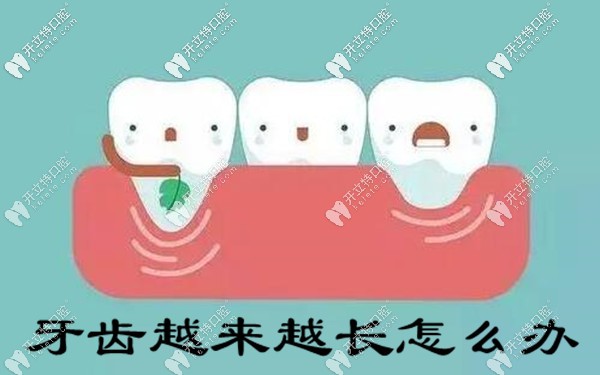 牙醫(yī)告訴你：牙齒越來越長怎么辦（附預(yù)防方法）