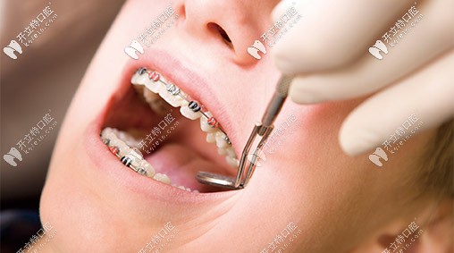 在材料的選用方面很用心