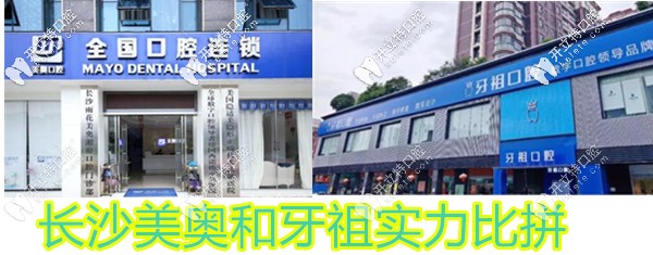 都是連鎖牙科長(zhǎng)沙牙祖和美奧到底哪個(gè)好?