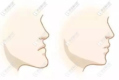 長(zhǎng)沙地包天矯正做的好的醫(yī)院名單，兒童成人都有