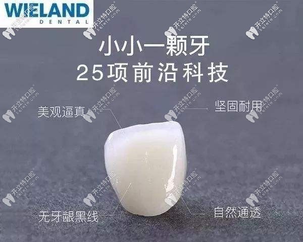 威蘭德全瓷冠