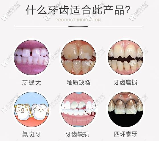 適合做EMAX瓷貼面的牙齒情況