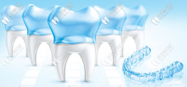 時代天使comfos青春版牙套多久換一次