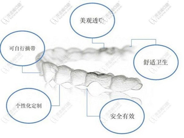 無托槽隱形矯正 無托槽隱形矯正