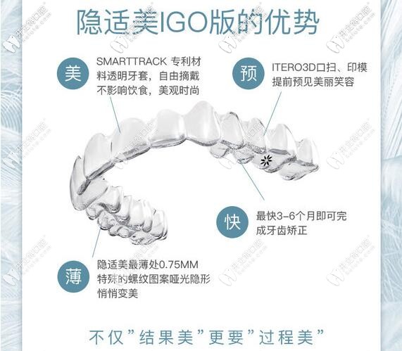 深圳銘德口腔隱適美Igo極速版矯正器
