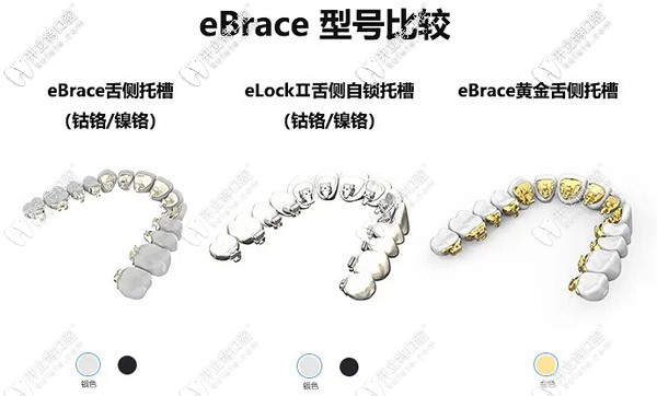 國產(chǎn)Ebrace舌側(cè)矯正起器型號對比