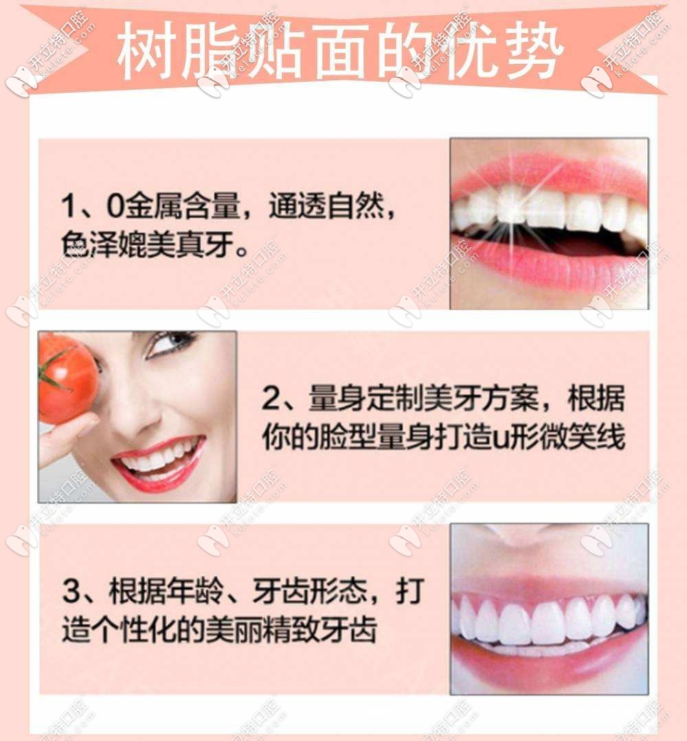 樹脂貼面的優(yōu)勢(shì)