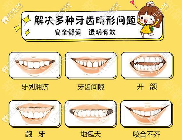 多種牙齒畸形的情況可通過矯正解決