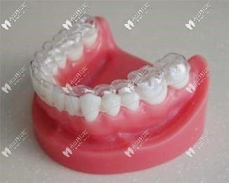 牙齒保持器