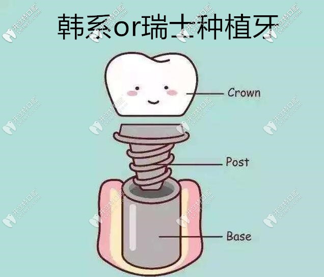 韓系和瑞士的價(jià)格差多少