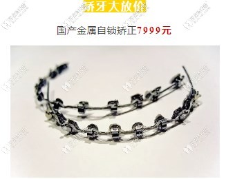 金屬自鎖托槽價格