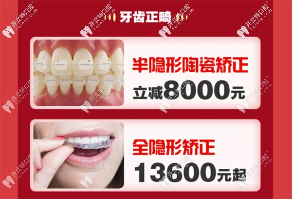 深圳銘德口腔做國產(chǎn)全隱形矯正價(jià)格13600元起
