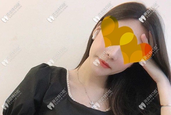 吳小姐做完正頜術后3個月圖