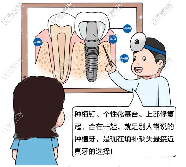 在廣州穗華口腔做1顆諾貝爾種植牙多少錢?過程疼不疼呢！