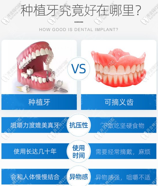 種植牙VS活動(dòng)假牙