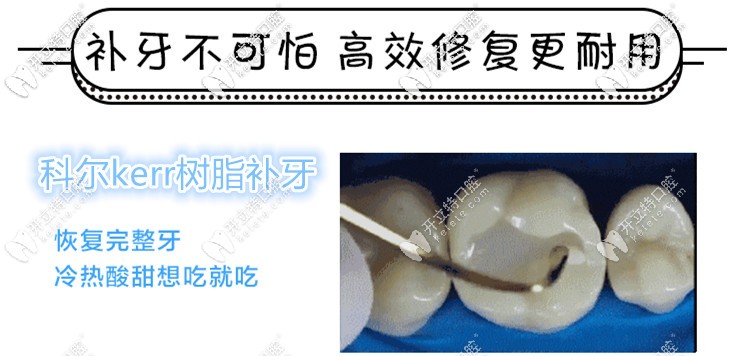 美國(guó)科爾kerr樹(shù)脂補(bǔ)牙多少錢(qián)一顆,與3m價(jià)位相差大嗎？