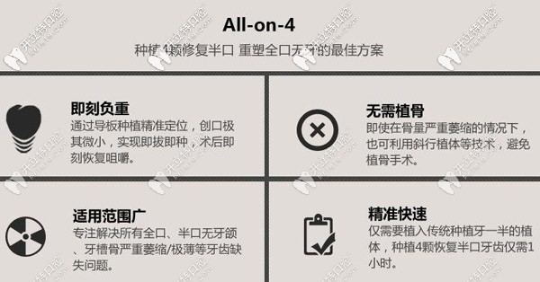 allon4即刻種植牙的特點(diǎn) allon4即刻種植牙的特點(diǎn)