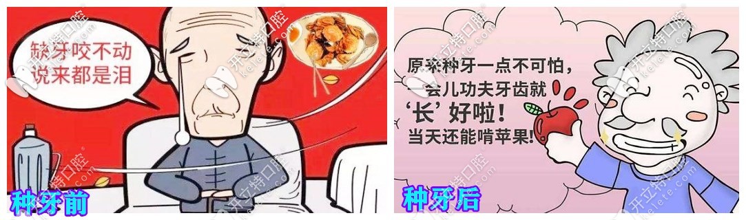 種牙前后的好處