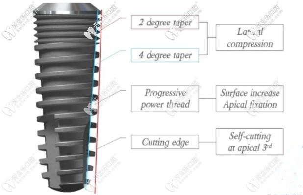 沃蘭it植體適合前牙種植