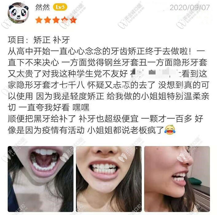 牙元素隱形牙套價格真便宜