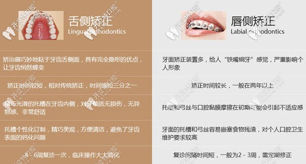 舌側(cè)和唇側(cè)矯正的對(duì)比